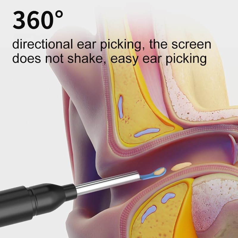 Cleansify Ear Endoscope Otoscope Ear Wax Cleaner Tool Kit
